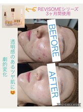 サロンデュヒャーク 志木駅前店(salon du ひゃーく)/大人気のルヴィソーム★