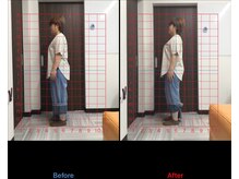 大久保ひまわり整骨院/一回でこの変化！！