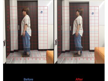 大久保ひまわり整骨院/一回でこの変化!!