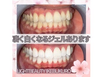 ライトビューティー 池袋店(LightBeauty)/症例写真