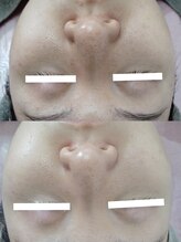 ビーユー(Be.you)/