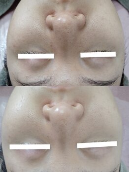 ビーユー(Be.you)/