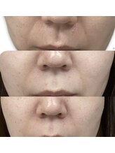 フェリス(feliz)/Before After[美肌フェイシャル]