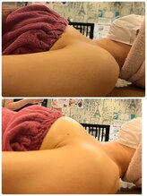 ロココ 豊田店(Rococo)/ビフォーアフター