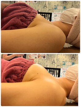 ロココ 豊田店(Rococo)/ビフォーアフター