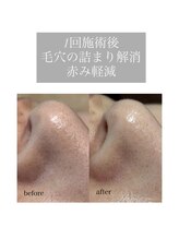 ルチア(Lucia di Piu Felice)/