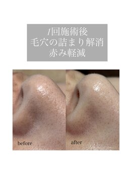 ルチア(Lucia di Piu Felice)/