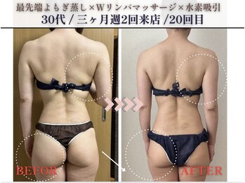 ヨサパーク カリーナ(YOSA PARK carina)/お客様BEFOR・AFTER