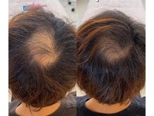 カルミア(kalmia)