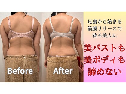 カエラ(Kaela)の写真