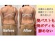 カエラ(Kaela)の写真