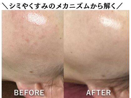 肌屋(HADA-YA)の写真