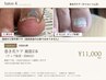 【2回目以降】巻き爪ケア 親指2本（チップ装着・約60分）￥11,000