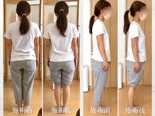 リブ(LIB)の雰囲気（【痩身整体+骨盤矯正】背中スリム,もっこり肩解消バストアップ◎）