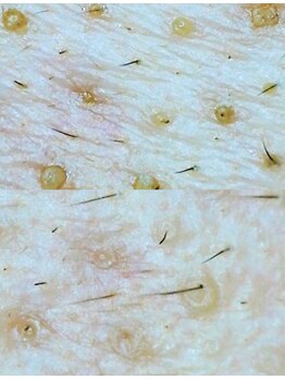 アネル 宮古島店(anel)/