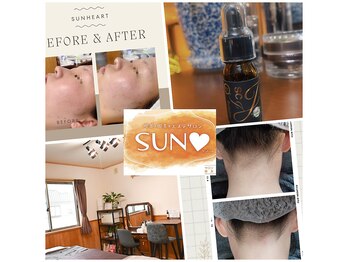 サンハート(SUN HEART)