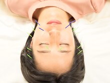 ハリ ヴァカンス(Hari Vacances)/肌管理美容鍼