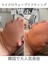 リリー(LILY)/韓国美容　LILY　