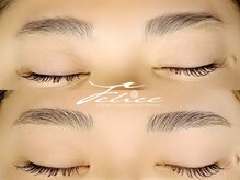 フェリーチェ(Felice)/ハリウッドブロウリフト