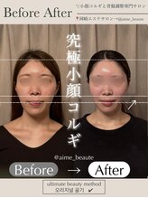 アイミーボーテ(Aime beaute)/コルギ