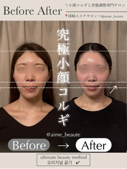 アイミーボーテ(Aime beaute)/コルギ