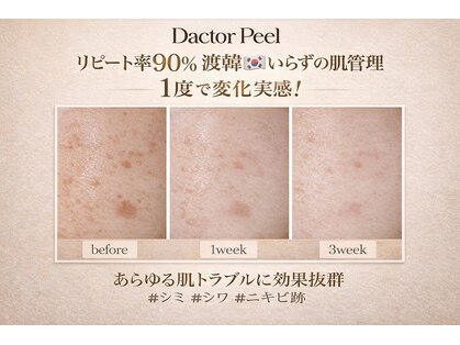 シュシュ(chouchou)の写真