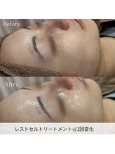 サロンベイア(salon Beia)/乾燥改善トリートメント♪