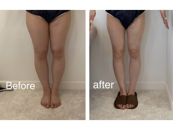 ソレイユ(Soleil)/堂々のハイパーナイフ