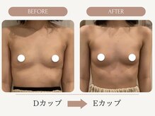 ウェルバスト(Well Bust)/【バストアップ例】D→Eカップ