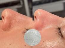 ルーナジェーナ(Luna llena)/池袋/目白/雑司ヶ谷/エステ