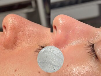 ルーナジェーナ(Luna llena)/池袋/目白/雑司ヶ谷/エステ