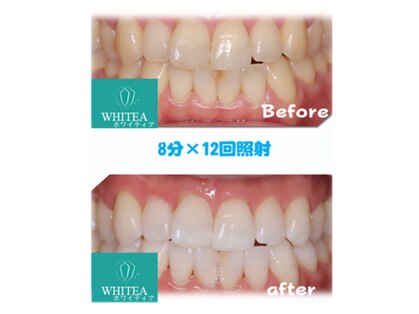 ホワイティア 東金店(WHITEA)の写真