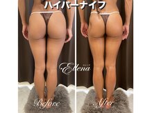 エレーナ 横浜(Ellena)/ハイパーナイフカット出し優勝店