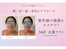 たるみ・小顔 肌育専門看護師サロン CLINICAL SALON Rinの雰囲気(次世代小顔リフト!切らずに叶える上質リフトアップ)