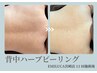【2回目以降のご来店】背中ハーブピーリング│2種のハーブから選べる¥22000