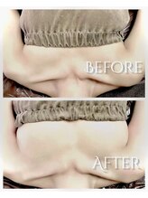 ミリノ(Mirino)/生体電流を整えバストアップへ