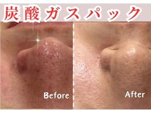 シー センター北(sii)/ハリ・弾力・潤いを同時に叶える