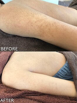 ビアンカ/お客様のお声