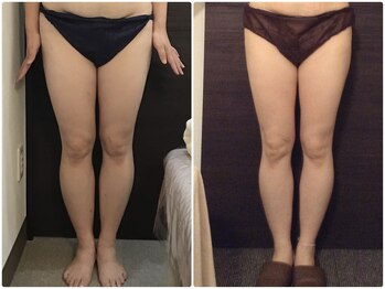 美容整体 ウェリナ 蟹江院/小顔矯正/骨盤矯正/美脚サロン