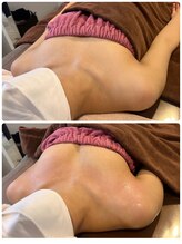 ロココ 豊田店(Rococo)/ビフォーアフター