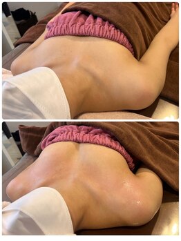 ロココ 豊田店(Rococo)/ビフォーアフター