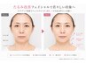【初めての肌管理】40代からのたるみ診断＋リフト体験 ￥5000