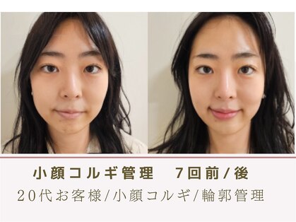 ルナビューティー 赤坂(LUNA beauty)の写真