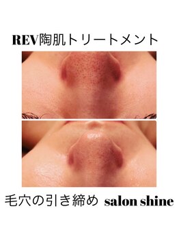サロンシャイン(Salon Shine)/REVI陶肌トリートメント