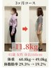 【7月限定！今年までに痩せたい40代の方】カウンセリング＆美容矯正
