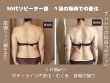 姿勢評価し筋肉・筋膜をリリース！軸が整いスッキリ美ボディへ◎