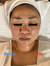 ミンク(Mink)/ほうれい線が短く♪