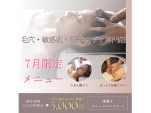 アペゼ(Apaiser)