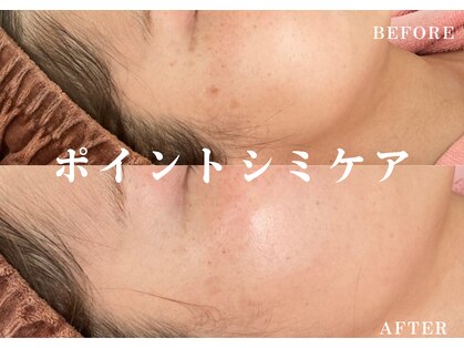 綺麗サロン 脱毛アンドフェイシャル ジュエル(Jewel)の写真