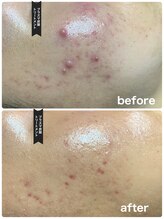 サロン フェリシア(salon Felicia)/Before/After